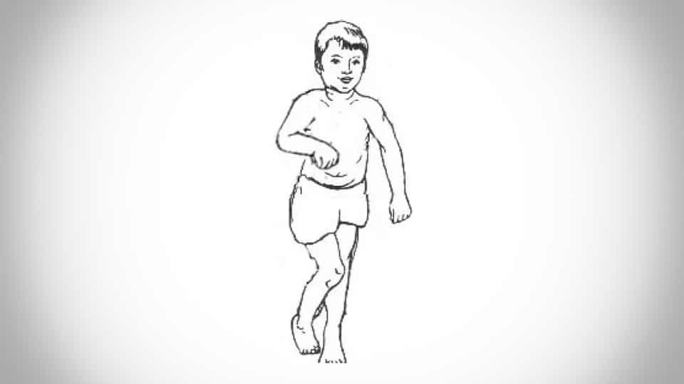 ДЦП 1-2 степени, ДЦП-синдром